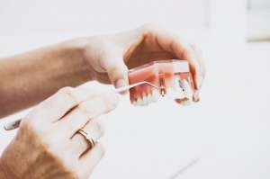 Full Arch Restoration: Is All-on-4 Dental Implants Right for You? Full Arch Restoration: Is All-on-4 Dental Implants Right for You?